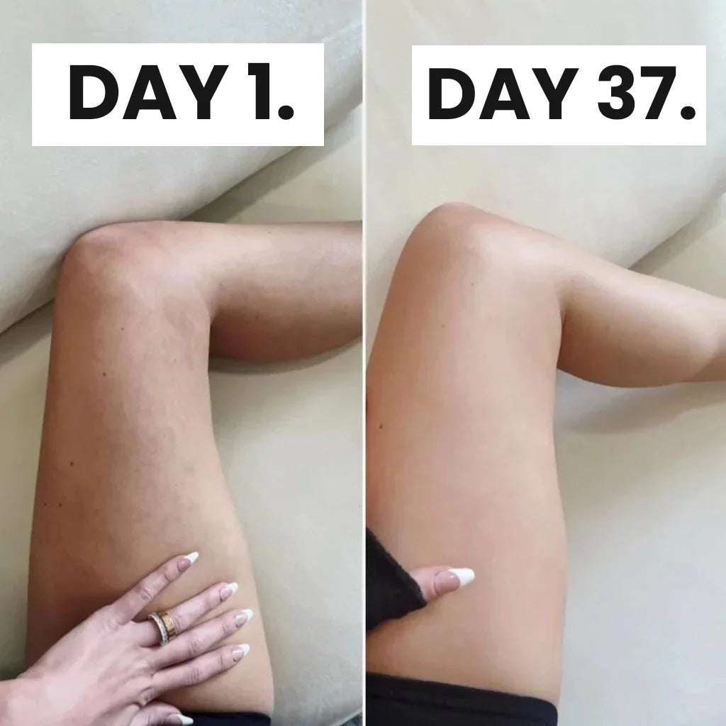 Anti-Cellulite Cupping Massager